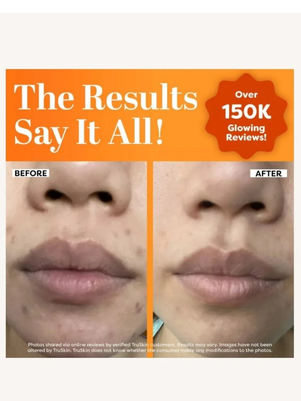 TruSkin Vitamin C Serum
